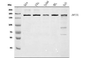 Western blot analysis of SMARCC1/BAF155 using anti-SMARCC1/BAF155 antibody (ABIN7602175).