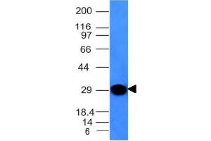 anti-Immunoglobulin kappa Constant (IGKC) antibody