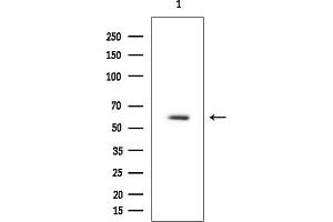Western blot analysis of lysates from Rat brain, using c-Myc Mouse Monoclonal Antibody at 1/1000 dilution.