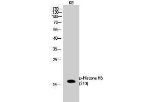 Western Blotting (WB) image for anti-Histone 3 (H3) (pSer10) antibody (ABIN3179450) (Histone 3 anticorps  (pSer10))
