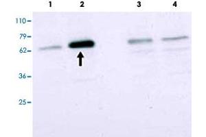 Western blot using SMAD2 polyclonal antibody  to detect over-expressed SMAD2 in COS cells (arrow). (SMAD2 anticorps  (Internal Region))