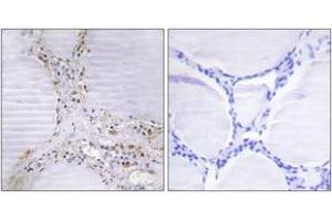 Immunohistochemistry analysis of paraffin-embedded human thyroid gland tissue, using BMX Antibody. (BMX anticorps  (AA 11-60))