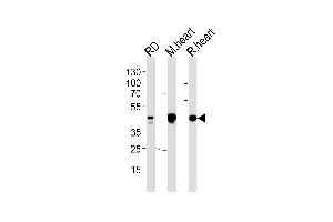PDK2 Antibody (ABIN653784 and ABIN2843071) western blot analysis in RD cell line and mouse heart,rat heart lysates (35 μg/lane).
