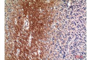 Immunohistochemistry (IHC) analysis of paraffin-embedded Human Brain, antibody was diluted at 1:100. (Complement C4A/C4B (Internal Region) anticorps)
