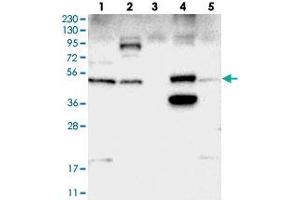 Western blot analysis of Lane 1: RT-4, Lane 2: U-251 MG, Lane 3: Human Plasma, Lane 4: Liver, Lane 5: Tonsil with SNX30 polyclonal antibody  at 1:250-1:500 dilution.