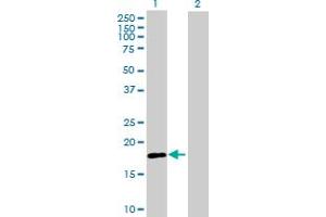 Western Blot analysis of RNF170 expression in transfected 293T cell line by RNF170 MaxPab polyclonal antibody. (RNF170 anticorps  (AA 1-200))