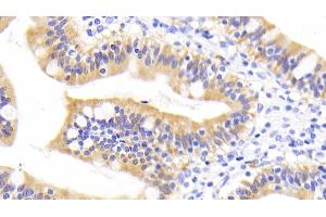 Detection of RBP2 in Human Small intestine Tissue using Monoclonal Antibody to Retinol Binding Protein 2, Cellular (RBP2) (RBP2 anticorps  (AA 1-134))