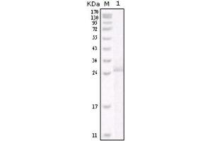 Western Blotting (WB) image for anti-Receptor tyrosine-protein kinase erbB-2 (ErbB2/Her2) antibody (ABIN1845273) (ErbB2/Her2 anticorps)