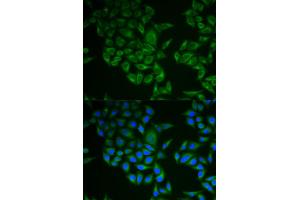 Immunofluorescence analysis of A549 cells using CD247 antibody (ABIN5971089). (CD247 anticorps)