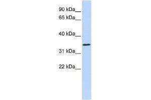 ZNF660 antibody used at 0. (ZNF660 anticorps  (N-Term))