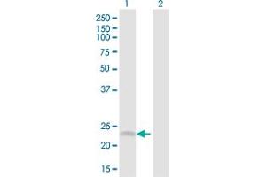 Western Blot analysis of SRD5A1 expression in transfected 293T cell line by SRD5A1 MaxPab polyclonal antibody.