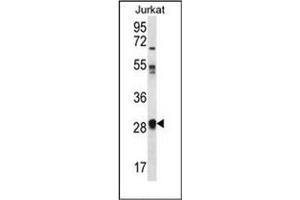 Western blot analysis of OR11L1 Antibody (C-term) in Jurkat cell line lysates (35ug/lane). (OR11L1 anticorps  (C-Term))