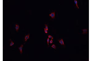 anti-Histo-blood group A transferase (ABO) (N-Term) antibody