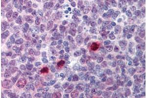 anti-Extra Spindle Poles Like 1 (ESPL1) (AA 586-702) antibody