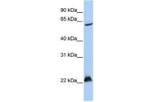 WB Suggested Anti-MGRN1 Antibody Titration:  0. (Mahogunin RING Finger Protein 1 anticorps  (Middle Region))
