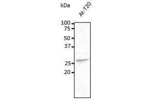 Anti-Rab5c Ab at 1/500 dilution, lysates at 100 µg per Iane, rabbit polyclonal to goat lgG (HRP) at 1/10,000 dilution, (Rab5c anticorps  (C-Term))