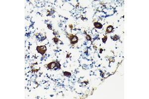 Immunohistochemistry of paraffin-embedded rat bone marrow using Integrin beta 3 (ITGB3/CD61) Rabbit pAb (ABIN6127572, ABIN6142584, ABIN6142586 and ABIN6219636) at dilution of 1:100 (40x lens). (Integrin beta 3 anticorps  (AA 610-718))
