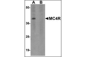 Western blot analysis of MC4R in rat brain tissue lysate with this product at 1 μg/ml in (A) the absence and (B) the presence of blocking peptide. (MC4R anticorps  (N-Term))