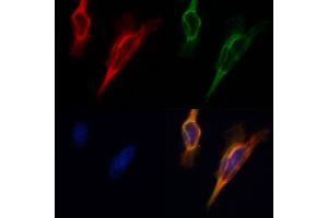 ABIN6265092 and ABIN6268681 staining Hela by IF/ICC. (SIRT3 anticorps  (C-Term))