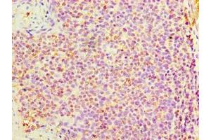 Immunohistochemistry of paraffin-embedded human tonsil tissue using ABIN7150869 at dilution of 1:100 (DNAH3 anticorps  (AA 1-150))