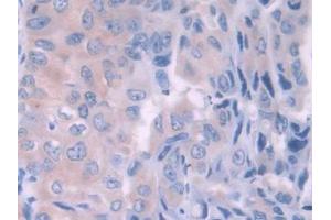 Used in DAB staining on fromalin fixed paraffin- embedded kidney tissue (HFE2 anticorps  (AA 234-416))