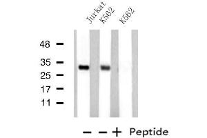 Western blot analysis of extracts from Jurkat/K562 cells, using MED8 antibody.
