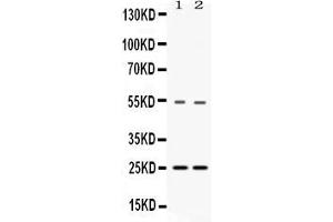 Western blot analysis of SYBL1 expression in rat liver extract ( Lane 1) and HELA whole cell lysates ( Lane 3). (VAMP7 anticorps  (AA 24-190))