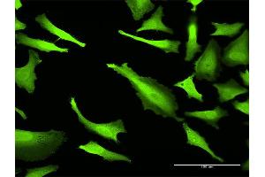 Immunofluorescence of monoclonal antibody to ABCC2 on HeLa cell.
