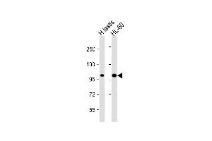 All lanes : Anti-SENP6 Antibody  at 1:1000 dilution Lane 1: human testis lysate Lane 2: HL-60 whole cell lysate Lysates/proteins at 20 μg per lane. (SENP6 anticorps  (C-Term))