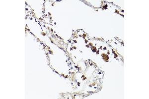 Immunohistochemistry of paraffin-embedded human lung using Ferritin Heavy Chain Rabbit mAb (ABIN7267168) at dilution of 1:100 (40x lens).