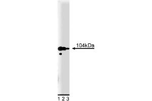Western blot analysis of Adaptin gamma on PC12 cell lysate. (gamma 1 Adaptin anticorps  (AA 642-821))