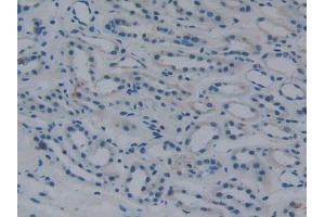 IHC-P analysis of Human Kidney Tissue, with DAB staining. (Fibrinogen beta Chain anticorps  (AA 45-491))