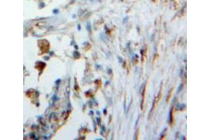 Used in DAB staining on fromalin fixed paraffin-embedded lung tissue