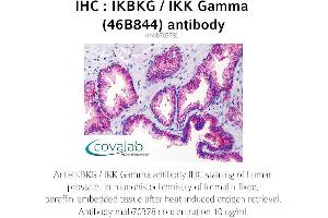 Image no. 2 for anti-Inhibitor of kappa Light Polypeptide Gene Enhancer in B-Cells, Kinase gamma (IKBKG) antibody (ABIN5693607)