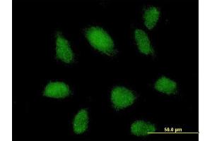 Immunofluorescence of purified MaxPab antibody to TRIM62 on HeLa cell. (TRIM62 anticorps  (AA 1-475))