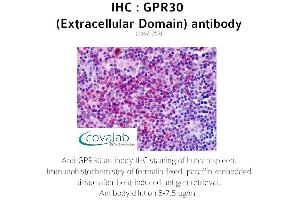 anti-G Protein-Coupled Estrogen Receptor 1 (GPER) (2nd Extracellular Domain) antibody