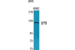 Western Blot (WB) analysis of specific cells using ST5 Polyclonal Antibody. (ST5 anticorps  (Internal Region))