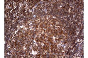 Image no. 2 for anti-Tuberous Sclerosis 1 (TSC1) (AA 836-1164) antibody (ABIN1491686)