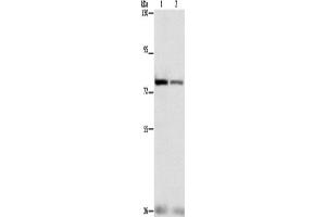 Western Blotting (WB) image for anti-Nuclear Factor (erythroid-Derived 2)-Like 1 (NFE2L1) antibody (ABIN2428493) (NFE2L1 anticorps)