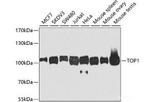 Western blot analysis of extracts of various cell lines using TOP1 Polyclonal Antibody at dilution of 1:1000. (Topoisomerase I anticorps)