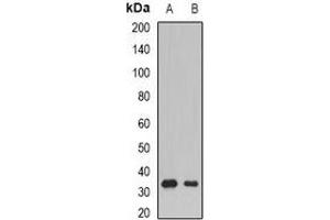 Western blot analysis of SSX5 expression in Raji (A), mouse skeletal muscle (B) whole cell lysates. (SSX5 anticorps)