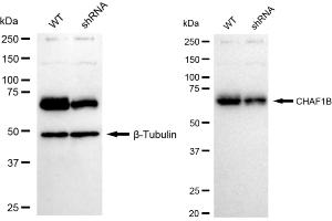 anti-Chromatin Assembly Factor 1, Subunit B (p60) (CHAF1B) antibody