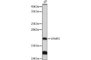 Western blot analysis of extracts of RD cells, using V Rabbit mAb (ABIN7271313) at 1:1000 dilution. (VAMP2 anticorps)