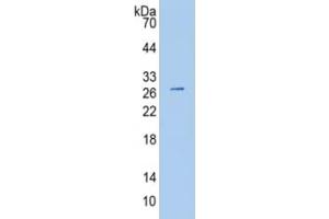 WB of Protein Standard: different control antibodies against Highly purified E. (PAPPA2 Kit CLIA)