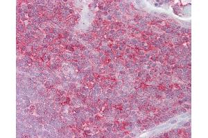 Anti-KIF2A antibody IHC of human thymus.