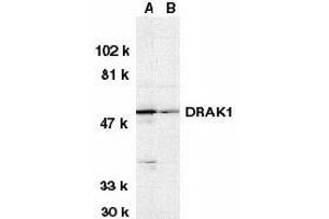 Western blot analysis of DRAK1 in (A) MOLT4 and (B) A431 whole cell lysates with AP30302PU-N DRAK1 antibody at 1 μg/ml.