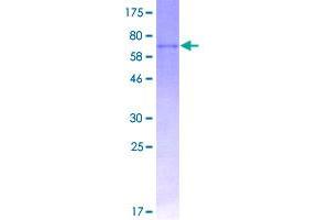 Image no. 1 for Tumor Necrosis Factor Receptor Superfamily, Member 11b (TNFRSF11B) (AA 22-401) protein (GST tag) (ABIN1323155)