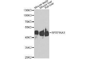 Western blot analysis of extracts of various cell lines, using SERPINA3 antibody.