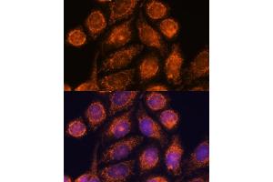 Immunofluorescence analysis of HeLa cells using MTMR9 antibody (ABIN6128253, ABIN6144163, ABIN6144164 and ABIN6217000) at dilution of 1:100.