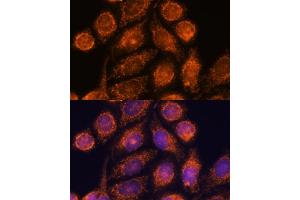 Immunofluorescence analysis of HeLa cells using MTMR9 antibody (ABIN6128253, ABIN6144163, ABIN6144164 and ABIN6217000) at dilution of 1:100. (MTMR9 anticorps  (AA 1-250))